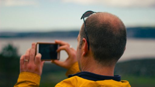 Back of man's balding head