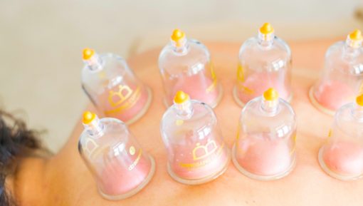 What is Cupping Therapy